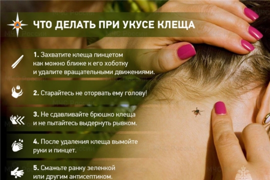 Что делать, если обнаружили на себе клеща? 