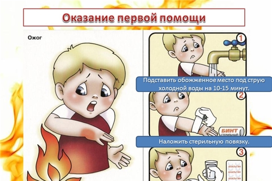 Первая помощь при ожогах